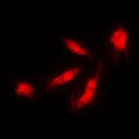 ICC/IF analysis of formalin-fixed HeLa cells using GTX55905 p35 antibody. Red : Primary antibody Blue : DAPI Permeabilization : 0.1% Triton X-100 in TBS for 5-10 minutes ICC/IF analysis of formalin-fixed HeLa cells using GTX55905 p35 antibody. Red : Primary antibody Blue : DAPI Permeabilization : 0.1% Triton X-100 in TBS for 5-10 minutes