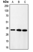 WB analysis of rat brain (A), HeLa (B), A431 (C) whole cell lysates using GTX55905 p35 antibody.