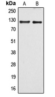 WB analysis of HUVEC (A), Raw264.7 (B) whole cell lysates using GTX55910 ARHGEF1 antibody. WB analysis of HUVEC (A), Raw264.7 (B) whole cell lysates using GTX55910 ARHGEF1 antibody.