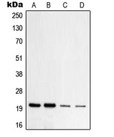 WB analysis of HeLa (A), HepG2 (B), NIH3T3 (C), PC12 (D) whole cell lysates using GTX55919 TOMM20 antibody. WB analysis of HeLa (A), HepG2 (B), NIH3T3 (C), PC12 (D) whole cell lysates using GTX55919 TOMM20 antibody.