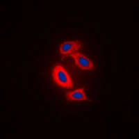ICC/IF analysis of formalin-fixed Raw264.7 cells using GTX55929 RAB31 antibody. Red : Primary antibody Blue : DAPI Permeabilization : 0.1% Triton X-100 in TBS for 5-10 minutes ICC/IF analysis of formalin-fixed Raw264.7 cells using GTX55929 RAB31 antibody. Red : Primary antibody Blue : DAPI Permeabilization : 0.1% Triton X-100 in TBS for 5-10 minutes