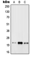 WB analysis of MCF7 (A), Raw264.7 (B), rat brain (C) whole cell lysates using GTX55929 RAB31 antibody.