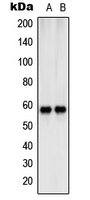 WB analysis of Jurkat (A), NIH3T3 (B) whole cell lysates using GTX55939 SHC2 antibody. WB analysis of Jurkat (A), NIH3T3 (B) whole cell lysates using GTX55939 SHC2 antibody.