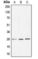 WB analysis of HT29 (A), HeLa (B), MCF7 (C) whole cell lysates using GTX55940 BRMS1 antibody.