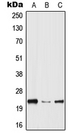 WB analysis of THP1 (A), Raw264.7 (B), PC12 (C) whole cell lysates using GTX55947 HPGDS antibody.