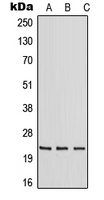 WB analysis of HeLa (A), mouse liver (B), rat liver (C) whole cell lysates using GTX55948 RAB30 antibody. WB analysis of HeLa (A), mouse liver (B), rat liver (C) whole cell lysates using GTX55948 RAB30 antibody.