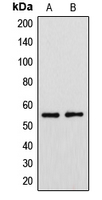 WB analysis of HeLa (A), HUVEC (B) whole cell lysates using GTX55952 CYP39A1 antibody.