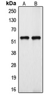 WB analysis of HeLa (A), HUVEC (B) whole cell lysates using GTX55953 CYP39A1 antibody.