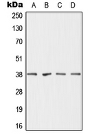 WB analysis of MCF7 (A),HepG2 (B),mouse liver (C),rat liver (D) whole cell lysates using GTX55954 DHRS7 antibody.