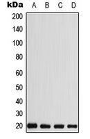 WB analysis of MDMB435 (A), HEK293T (B), SP2/0 (C), H9C2 (D) whole cell lysates using GTX55964 CABP5 antibody. WB analysis of MDMB435 (A), HEK293T (B), SP2/0 (C), H9C2 (D) whole cell lysates using GTX55964 CABP5 antibody.