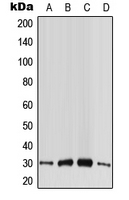 WB analysis of HeLa (A), HepG2 (B), SP2/0 (C), PC12 (D) whole cell lysates using GTX55968 CABP4 antibody. WB analysis of HeLa (A), HepG2 (B), SP2/0 (C), PC12 (D) whole cell lysates using GTX55968 CABP4 antibody.