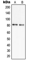 WB analysis of NCI-H460 (A), U251MG (B) whole cell lysates using GTX55991 SLC6A17 antibody. WB analysis of NCI-H460 (A), U251MG (B) whole cell lysates using GTX55991 SLC6A17 antibody.