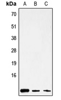 WB analysis of HepG2 (A), mouse brain (B), rat stomach (C) whole cell lysates using GTX55993 ATP8 antibody. WB analysis of HepG2 (A), mouse brain (B), rat stomach (C) whole cell lysates using GTX55993 ATP8 antibody.
