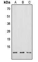 WB analysis of HEK293T (A), Raw264.7 (B), PC12 (C) whole cell lysates using GTX55995 Neuromedin B antibody. WB analysis of HEK293T (A), Raw264.7 (B), PC12 (C) whole cell lysates using GTX55995 Neuromedin B antibody.