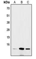 WB analysis of Hela (A), mouse brain (B), rat colon (C) whole cell lysates using GTX56005 BRI3 antibody. WB analysis of Hela (A), mouse brain (B), rat colon (C) whole cell lysates using GTX56005 BRI3 antibody.