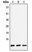 WB analysis of HEK293T (A), Raw264.7 (B), PC12 (C) whole cell lysates using GTX56023 beta 2 Defensin antibody. WB analysis of HEK293T (A), Raw264.7 (B), PC12 (C) whole cell lysates using GTX56023 beta 2 Defensin antibody.