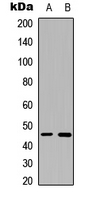 WB analysis of A549 (A), NS-1 (B) whole cell lysates using GTX56046 B4GALT6 antibody.