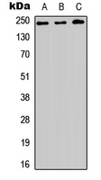 WB analysis of HEK293T (A), NS-1 (B), PC12 (C) whole cell lysates using GTX56047 HEATR1 antibody. WB analysis of HEK293T (A), NS-1 (B), PC12 (C) whole cell lysates using GTX56047 HEATR1 antibody.