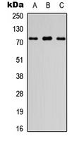 WB analysis of HEK293T (A), Raw264.7 (B), PC12 (C) whole cell lysates using GTX56054 FIGNL1 antibody. WB analysis of HEK293T (A), Raw264.7 (B), PC12 (C) whole cell lysates using GTX56054 FIGNL1 antibody.