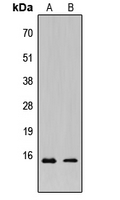 WB analysis of HeLa (A), MCF7 (B) whole cell lysates using GTX56058 KCNE1L antibody. WB analysis of HeLa (A), MCF7 (B) whole cell lysates using GTX56058 KCNE1L antibody.