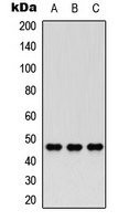 WB analysis of HEK293T (A), PC12 (B), HeLa (C) whole cell lysates using GTX56065 Nocturnin antibody. WB analysis of HEK293T (A), PC12 (B), HeLa (C) whole cell lysates using GTX56065 Nocturnin antibody.