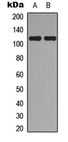WB analysis of A549 (A), MCF7 (B) whole cell lysates using GTX56078 TOP3A antibody. WB analysis of A549 (A), MCF7 (B) whole cell lysates using GTX56078 TOP3A antibody.