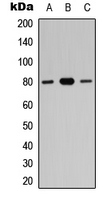 WB analysis of HEK293T (A), A549 (B), PC12 (C) whole cell lysates using GTX56080 ZNF441 antibody. WB analysis of HEK293T (A), A549 (B), PC12 (C) whole cell lysates using GTX56080 ZNF441 antibody.