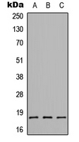 WB analysis of HEK293T (A), Raw264.7 (B), H9C2 (C) whole cell lysates using GTX56089 CMTM1 antibody. WB analysis of HEK293T (A), Raw264.7 (B), H9C2 (C) whole cell lysates using GTX56089 CMTM1 antibody.