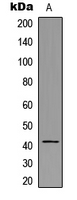 WB analysis of A431 (A) whole cell lysates using GTX56102 HLA-H antibody.
