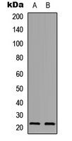 WB analysis of A549 (A), PC12 (B) whole cell lysates using GTX56115 PXMP2 antibody.