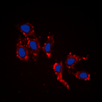 ICC/IF analysis of formalin-fixed HepG2 cells using GTX56118 RPL39 antibody. Red : Primary antibody Blue : DAPI Permeabilization : 0.1% Triton X-100 in TBS for 5-10 minutes ICC/IF analysis of formalin-fixed HepG2 cells using GTX56118 RPL39 antibody. Red : Primary antibody Blue : DAPI Permeabilization : 0.1% Triton X-100 in TBS for 5-10 minutes