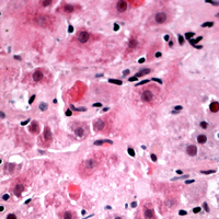 IHC-P analysis of formalin fixed human liver tissue section using GTX56118 RPL39 antibody. Antigen retrieval : Heat mediated antigen retrieval with sodium citrate buffer (pH 6.0)