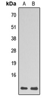 WB analysis of HL60 (A), HepG2 (B) whole cell lysates using GTX56118 RPL39 antibody.