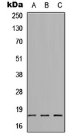 WB analysis of HEK293T (A), Raw264.7 (B), H9C2 (C) whole cell lysates using GTX56122 SYT8 antibody. WB analysis of HEK293T (A), Raw264.7 (B), H9C2 (C) whole cell lysates using GTX56122 SYT8 antibody.