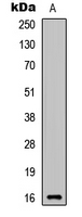WB analysis of SH-SY5Y (A) whole cell lysates using GTX56131 CYTL1 antibody. WB analysis of SH-SY5Y (A) whole cell lysates using GTX56131 CYTL1 antibody.