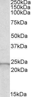 WB analysis of human liver lysate using GTX56140 GPX2 antibody, Internal. Dilution : 0.5microg/ml Loading : 30microg protein in RIPA buffer WB analysis of human liver lysate using GTX56140 GPX2 antibody, Internal. Dilution : 0.5microg/ml Loading : 30microg protein in RIPA buffer