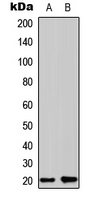 WB analysis of HepG2 (A), Hela (B) whole cell lysates using GTX56142 COPZ1 antibody.