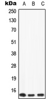 WB analysis of HeLa (A), mouse liver (B), rat liver (C) whole cell lysates using GTX56149 Apolipoprotein CII antibody. WB analysis of HeLa (A), mouse liver (B), rat liver (C) whole cell lysates using GTX56149 Apolipoprotein CII antibody.