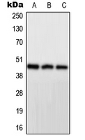 WB analysis of HeLa (A), mouse brain (B), H9C2 (C) whole cell lysates using GTX56164 PPP1R7 antibody. WB analysis of HeLa (A), mouse brain (B), H9C2 (C) whole cell lysates using GTX56164 PPP1R7 antibody.