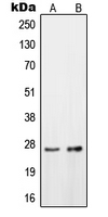 WB analysis of HeLa (A), HepG2 (B) whole cell lysates using GTX56189 OTUB2 antibody.