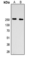 WB analysis of HEK293T (A), PC12 (B) whole cell lysates using GTX56208 Factor V Heavy chain antibody. WB analysis of HEK293T (A), PC12 (B) whole cell lysates using GTX56208 Factor V Heavy chain antibody.