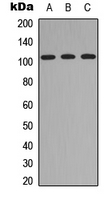 WB analysis of HEK293T (A), Raw264.7 (B), PC12 (C) whole cell lysates using GTX56210 ITIH4 antibody. WB analysis of HEK293T (A), Raw264.7 (B), PC12 (C) whole cell lysates using GTX56210 ITIH4 antibody.
