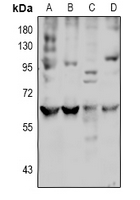 WB analysis of HEK293T (A), HepG2 (B), mouse kidney (C), rat brain (D) whole cell lysates using GTX56211 SLC7A8 antibody. WB analysis of HEK293T (A), HepG2 (B), mouse kidney (C), rat brain (D) whole cell lysates using GTX56211 SLC7A8 antibody.