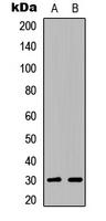 WB analysis of Jurkat (A), NIH3T3 (B) whole cell lysates using GTX56217 ATF5 antibody.