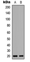 WB analysis of HeLa (A), H9C2 (B) whole cell lysates using GTX56220 BinCARD antibody. WB analysis of HeLa (A), H9C2 (B) whole cell lysates using GTX56220 BinCARD antibody.