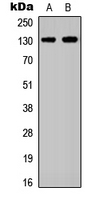 WB analysis of A431 (A), HEK293T (B) whole cell lysates using GTX56226 EphA2 antibody. WB analysis of A431 (A), HEK293T (B) whole cell lysates using GTX56226 EphA2 antibody.