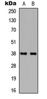 WB analysis of HEK293T (A), NIH3T3 (B) whole cell lysates using GTX56239 TBP antibody.