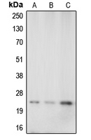 WB analysis of A549 (A), mouse brain (B), rat kidney (C) whole cell lysates using GTX56247 Caveolin 1 antibody. WB analysis of A549 (A), mouse brain (B), rat kidney (C) whole cell lysates using GTX56247 Caveolin 1 antibody.