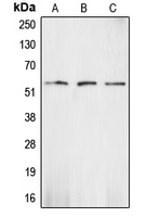 WB analysis of HeLa (A), mouse kidney (B), rat heart (C) whole cell lysates using GTX56248 Chk1 antibody.