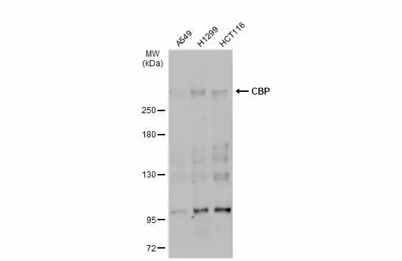 Various whole cell extracts (30 microg) were separated by 5% SDS-PAGE, and the membrane was blotted with CBP antibody (GTX56255) diluted at 1:500. The HRP-conjugated anti-rabbit IgG antibody (GTX213110-01) was used to detect the primary antibody, and the signal was developed with Trident ECL plus-Enhanced.